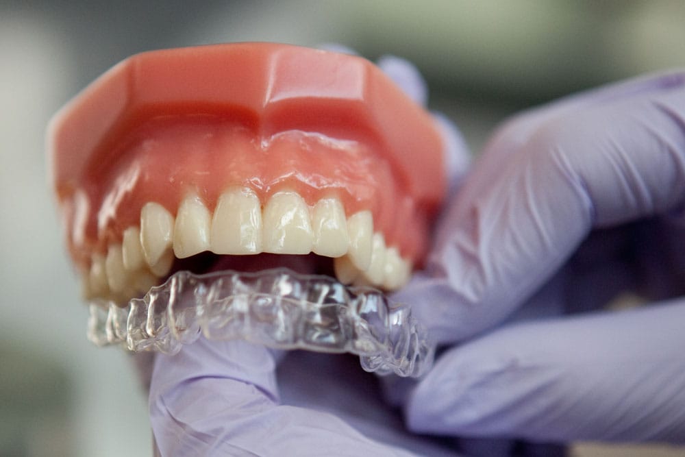 Invisalign Invisalign