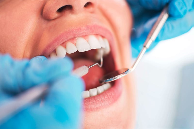 Situations When Fillings Are Offered to Elevate Your Oral Wellness Situations When Fillings Are Offered to Elevate Your Oral Wellness