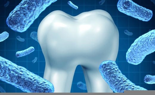 Halitosis: Bacteria Types That Cause the Smell Halitosis: Bacteria Types That Cause the Smell