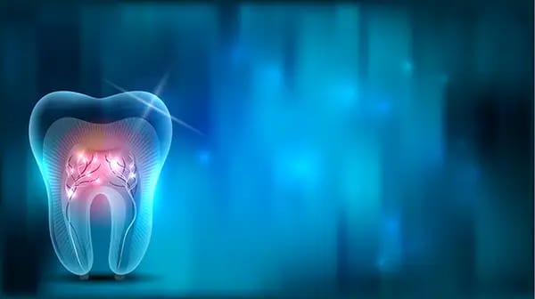 Illustration of tooth nerve inflammation explaining root canal treatment