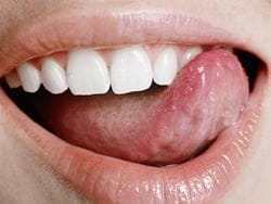 What's the story behind wisdom teeth? What's the story behind wisdom teeth?