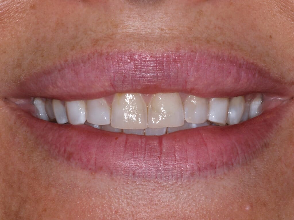 Virginia DC case 81 before