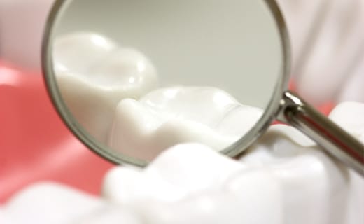 Dieting Your Way to Healthier Teeth