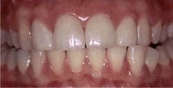 Patient 25600 After Photo