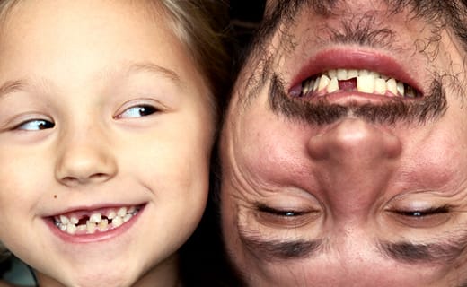 Deciding Between Dentures and Dental Implants Deciding Between Dentures and Dental Implants