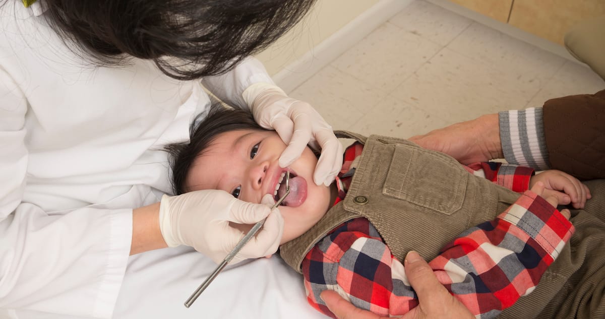Why Children Must Start Seeing a Kids’ Dentist at a Very Early Age