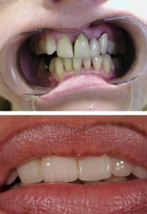 Before & After Walding and Associates
