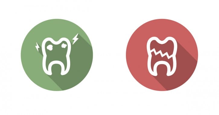 5 Popular Procedures for Treating a Broken Tooth 5 Popular Procedures for Treating a Broken Tooth