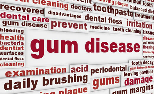 Attention, Teens - You’re Not Immune to Gum Disease Attention, Teens - You’re Not Immune to Gum Disease
