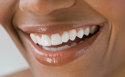 Quality Same-Day CEREC Crowns Quality Same-Day CEREC Crowns