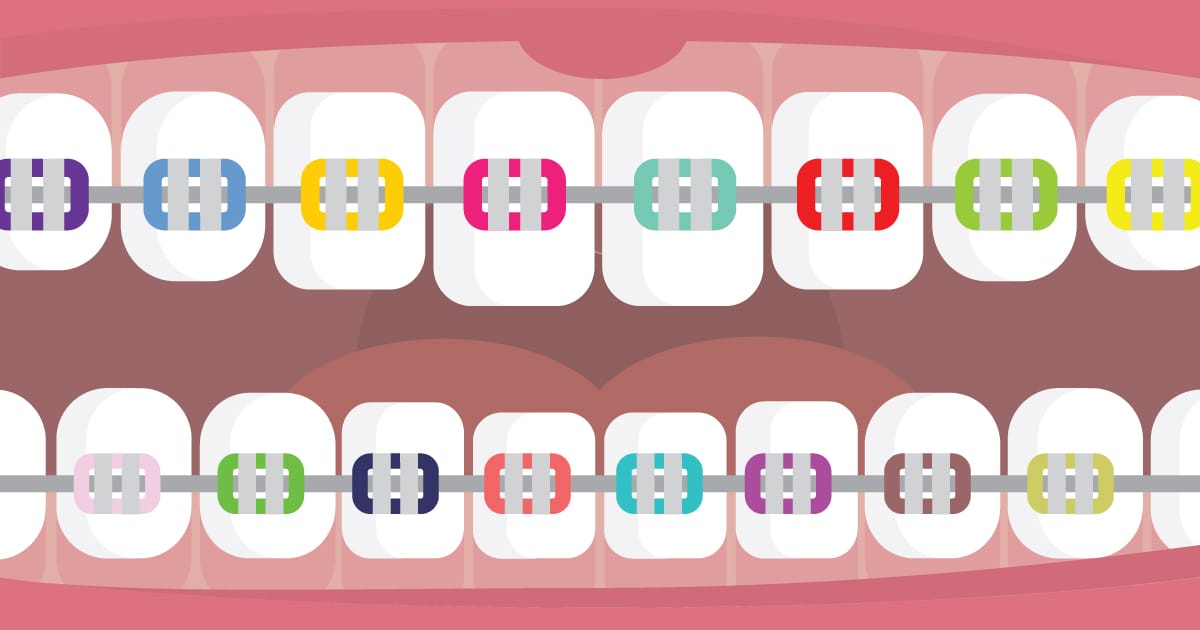 A Quick Guide to Orthodontic Terms A Quick Guide to Orthodontic Terms