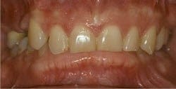 Patient 35348 Before Photo