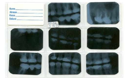 Why Dental X-Rays are Still Extremely Important in Dental Care Why Dental X-Rays are Still Extremely Important in Dental Care