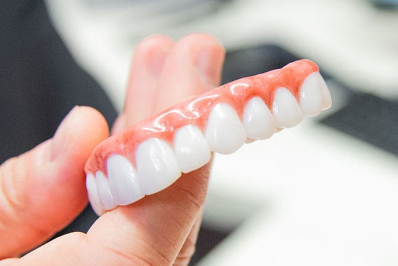 Full Fixed Set of Teeth Full Fixed Set of Teeth