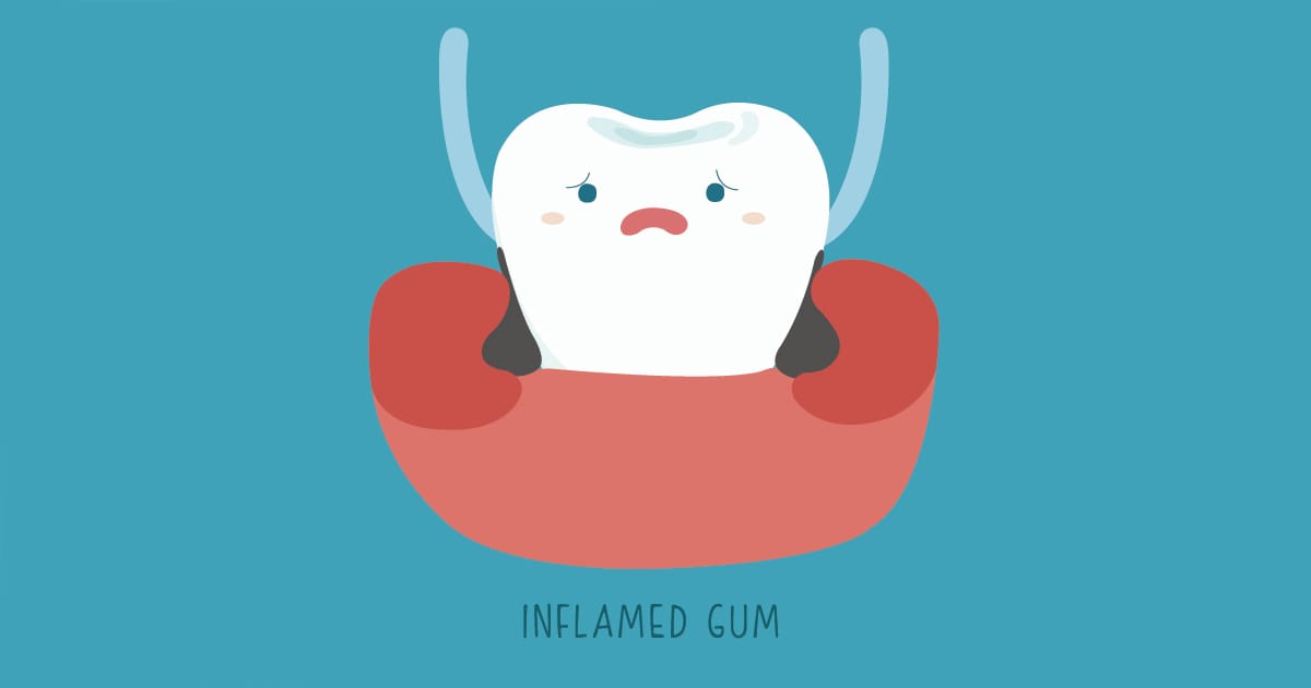 Detecting the Danger of Gum Disease Detecting the Danger of Gum Disease