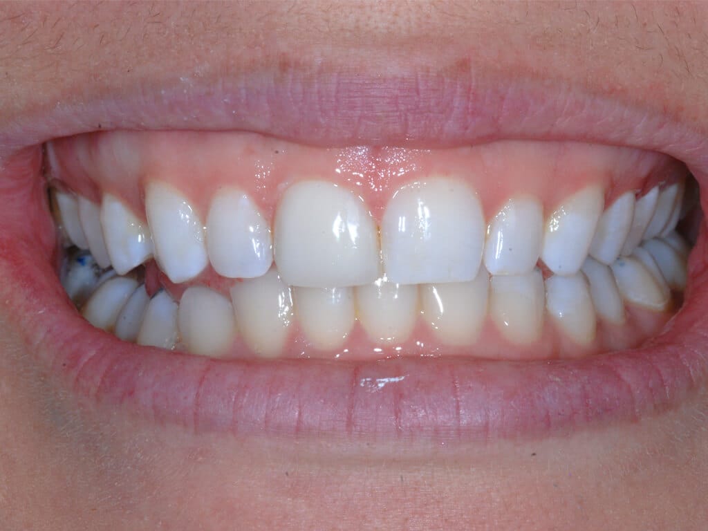 Virginia DC case 75 after