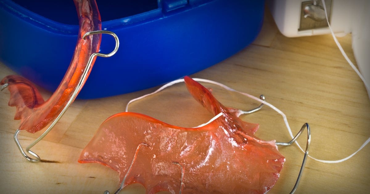 How to Care for Your Retainer How to Care for Your Retainer