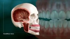 Bruxism (Clenching And Grinding) 002