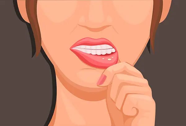 Woman examining mouth sore comparing canker sore versus cold sore symptoms Woman examining mouth sore comparing canker sore versus cold sore symptoms