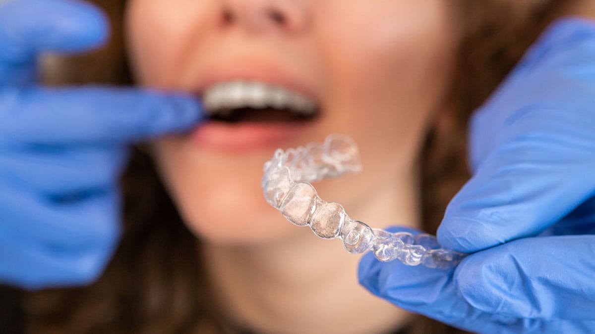 Post Orthodontic Care
