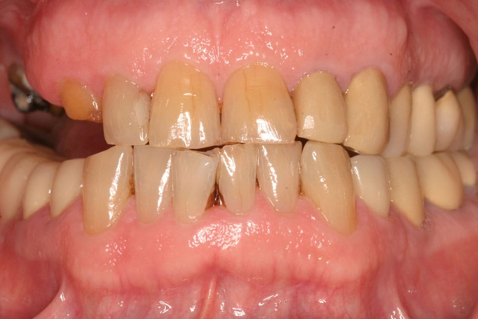 Rasner Smile gallery before 21