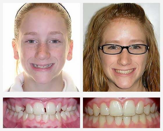 Smile Gallery Photo 1