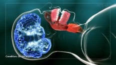 Obstructive Sleep Apnea 002