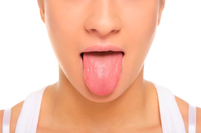 White Coating on the Tongue