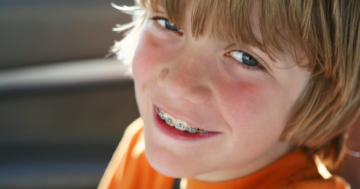 Your Guide to Braces Your Guide to Braces