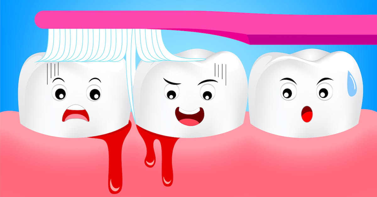 Causes of Bleeding Gums and Gum Disease Causes of Bleeding Gums and Gum Disease