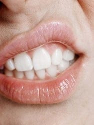 What should you do about your sensitive teeth? What should you do about your sensitive teeth?