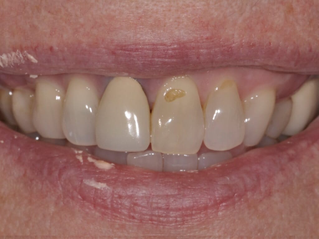 Virginia DC case 77 before