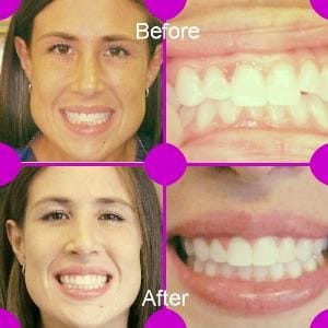 Before and after