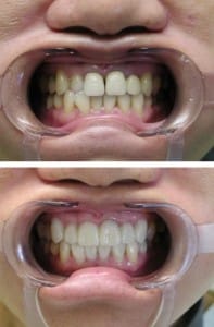 Before & After Walding and Associates