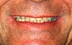 Smile Gallery - before