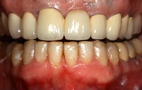 Smile Gallery - after
