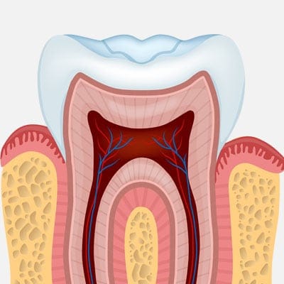 root-canal-square