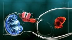 Obstructive Sleep Apnea 003