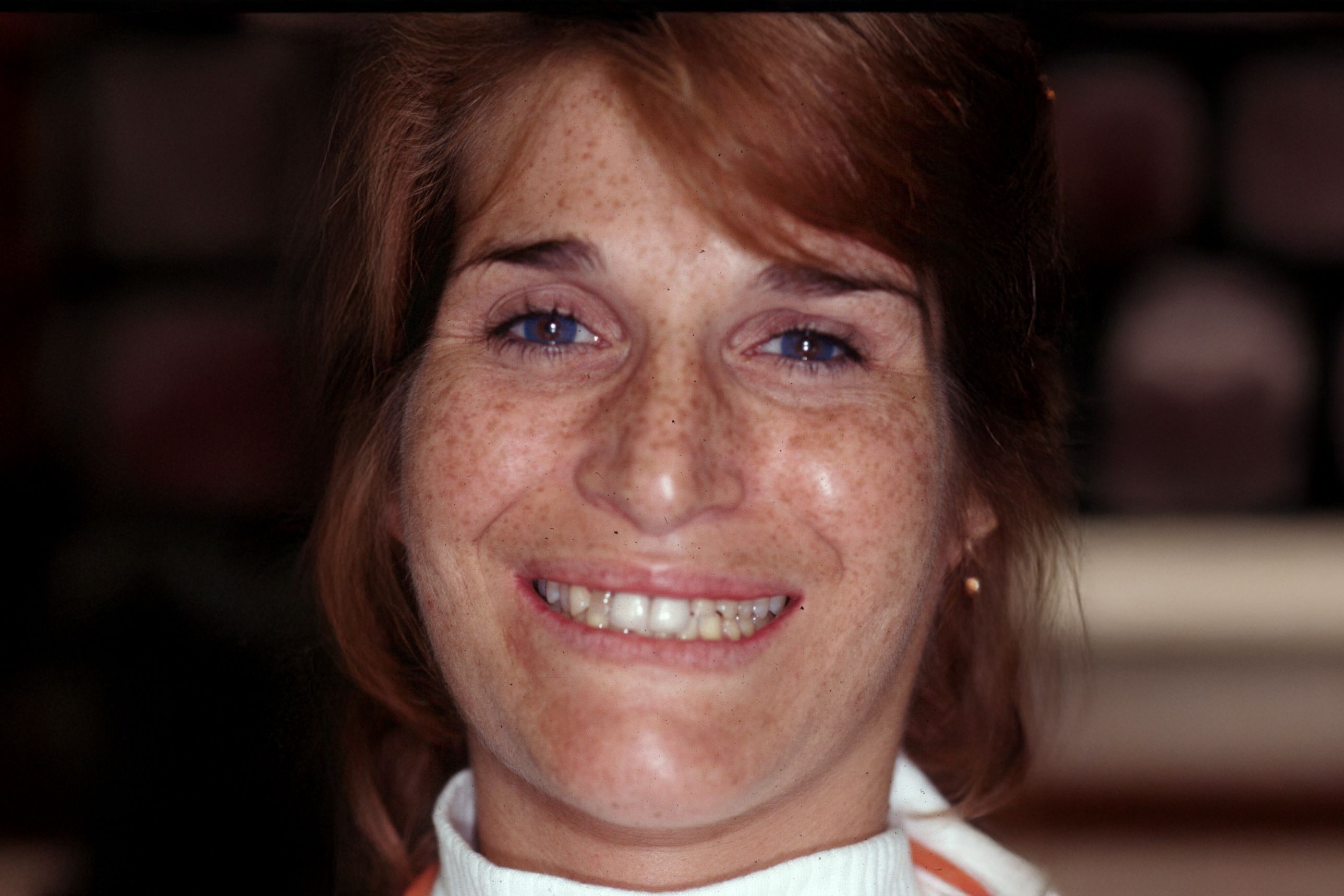 Rasner Smile gallery before 14