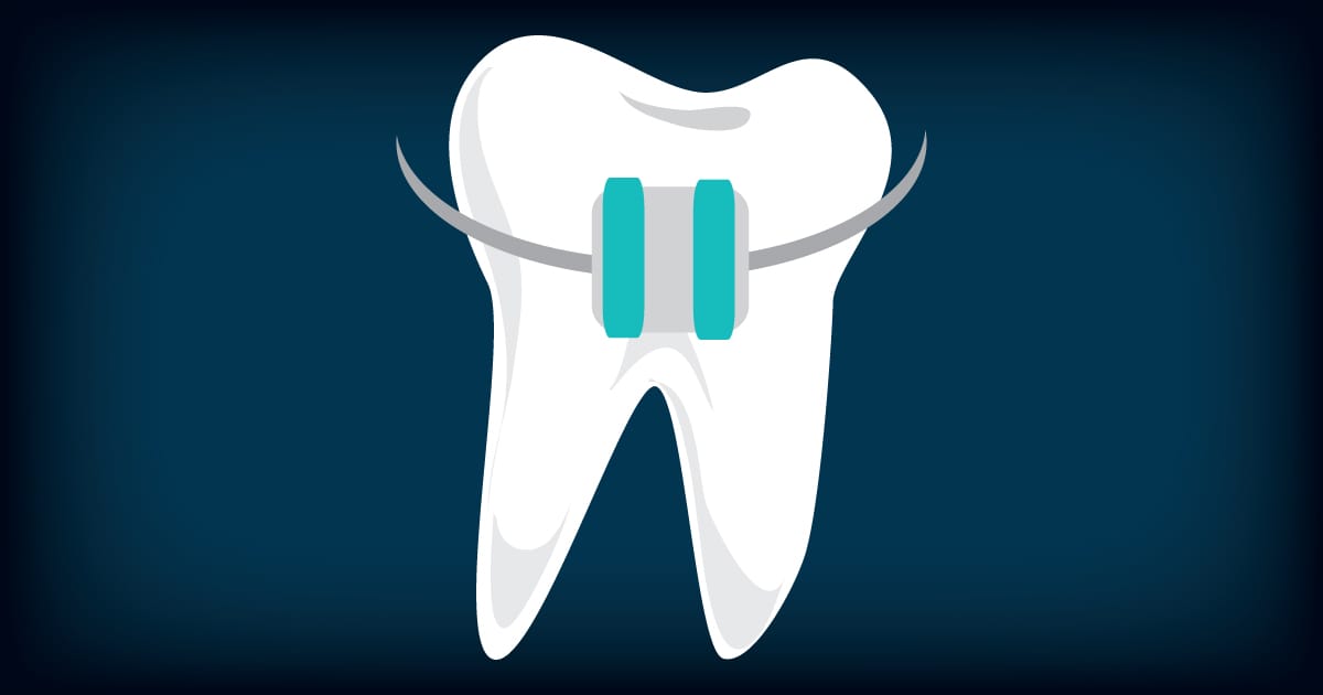 Orthodontics Emergencies - What to Do