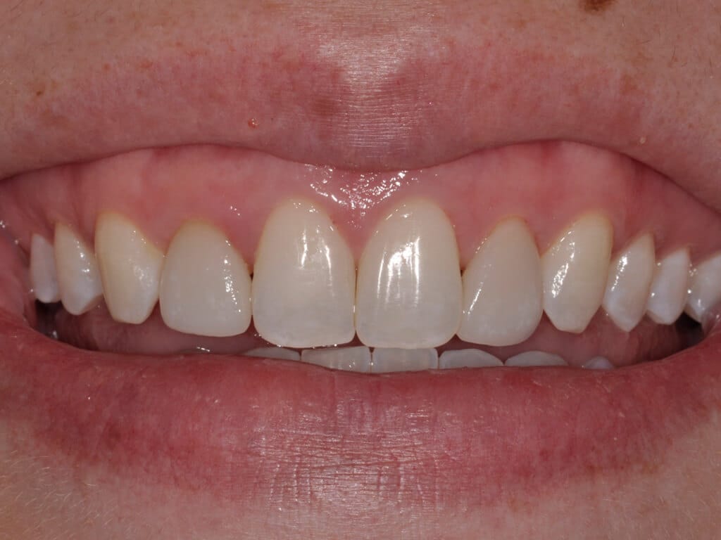 Virginia DC case 76 after