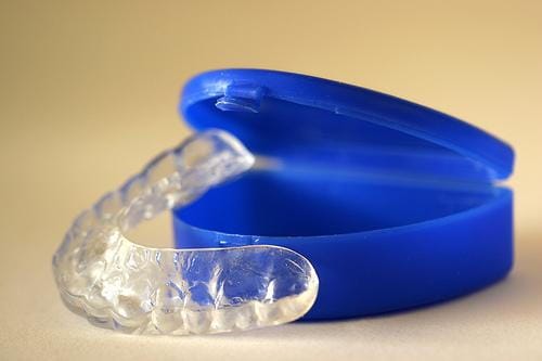 Mouthguard Q&A Mouthguard Q&A