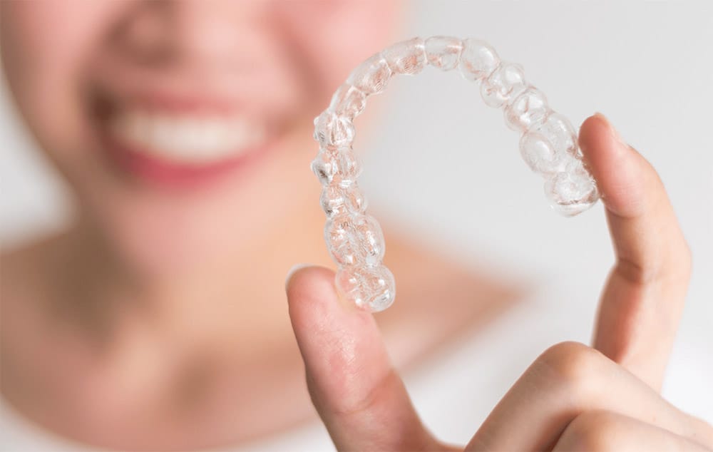 MadeYaSmile blog Invisalign MadeYaSmile blog Invisalign