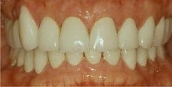 Patient 35348 After Photo