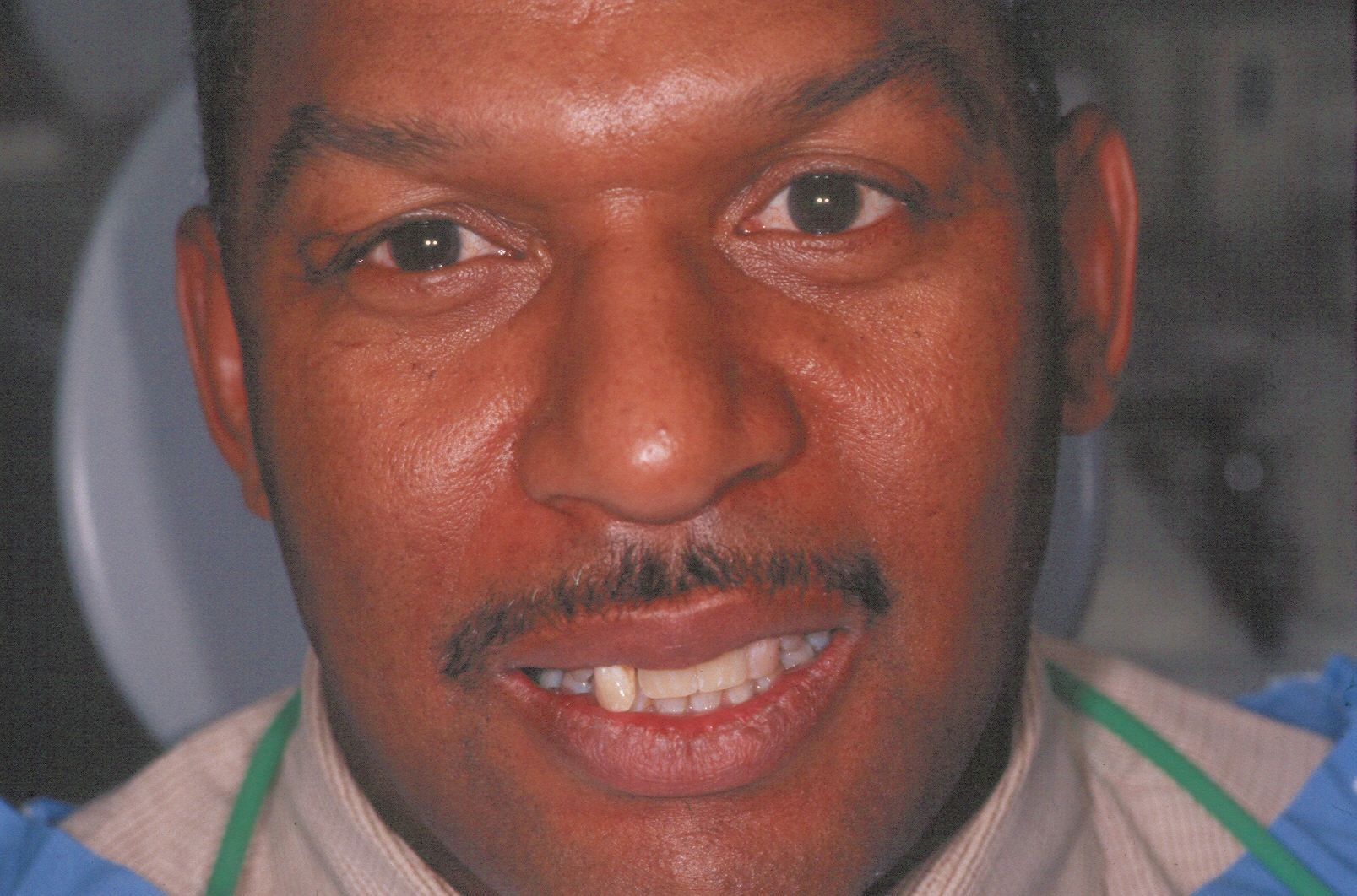 Rasner Smile gallery before 16