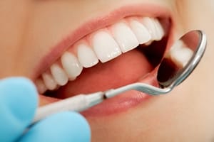 Healthy, attractive teeth affect how someone is perceived by others