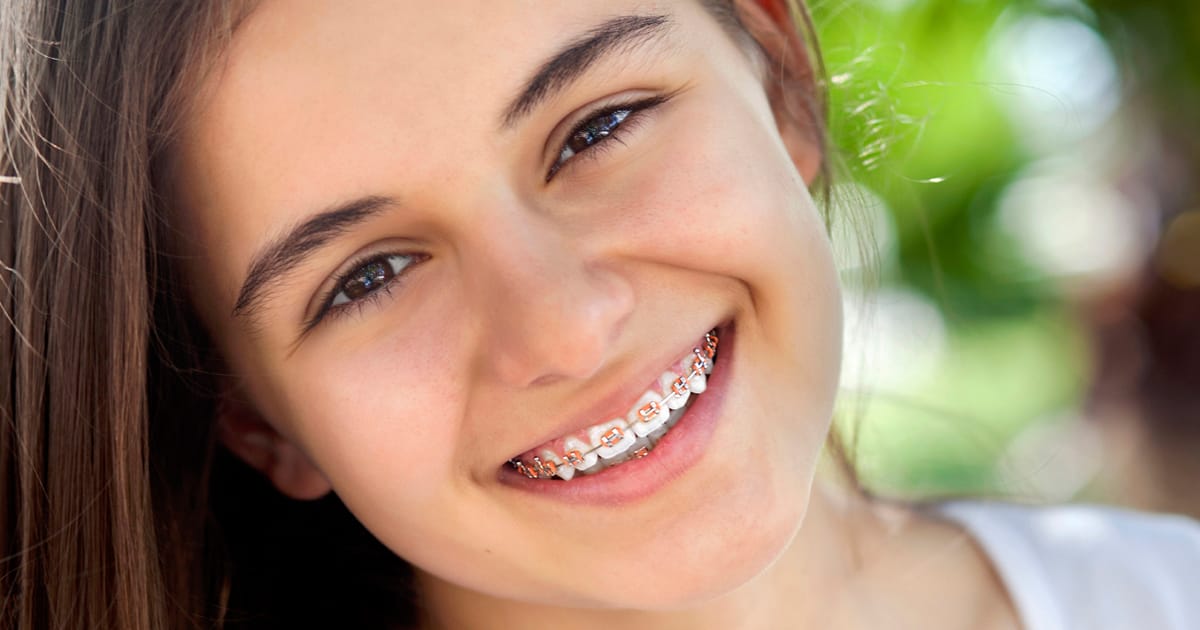 Orthodontics and Your Child - Why, When, and How Orthodontics and Your Child - Why, When, and How