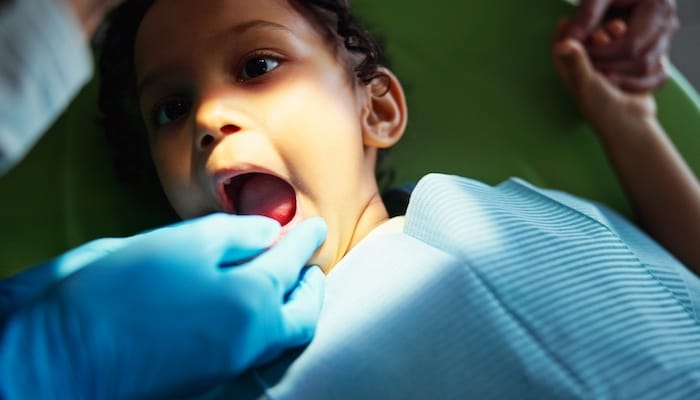 ACD tooth extractions service
