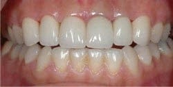 Patient 76610 After Photo