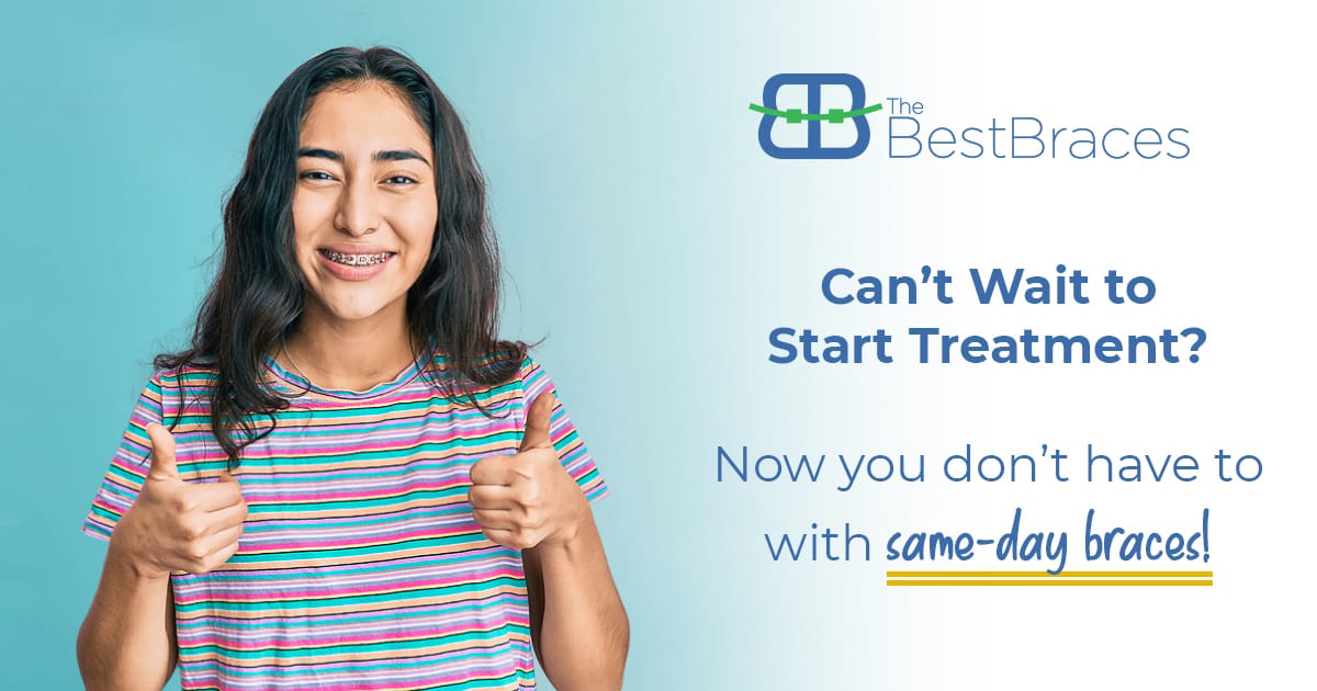 Can’t Wait To Start Treatment? Now You Don’t Have To With Same-Day Braces! Can’t Wait To Start Treatment? Now You Don’t Have To With Same-Day Braces!